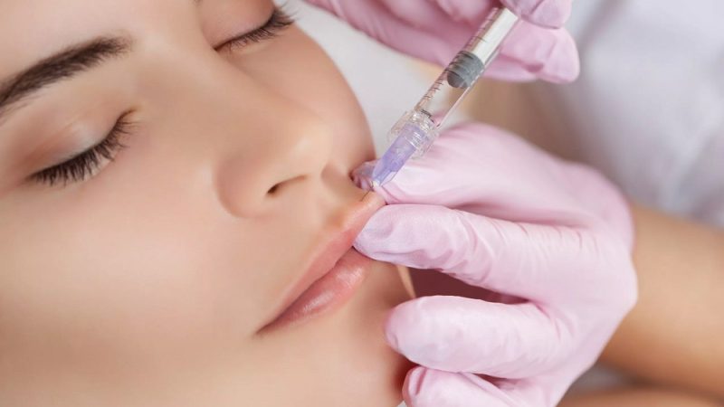 What Are The Advantages Of Saltaire Lip Filler?