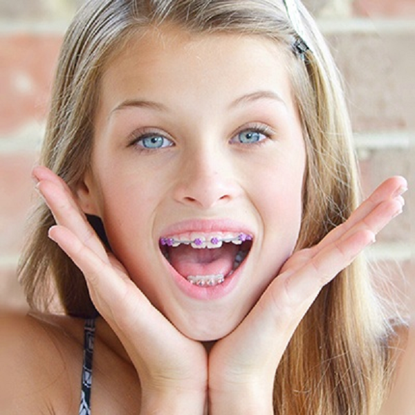 What Are The Benefits of Choosing Orthodontist for Kids?
