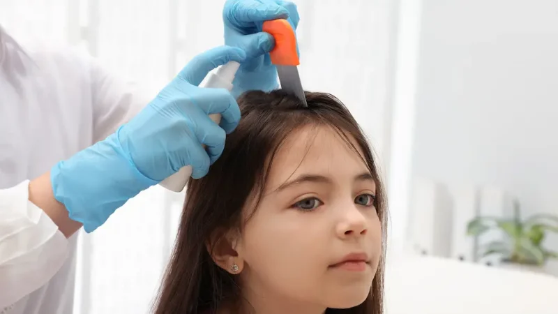 Demystifying Lice Reproduction: Determining Their Timeline
