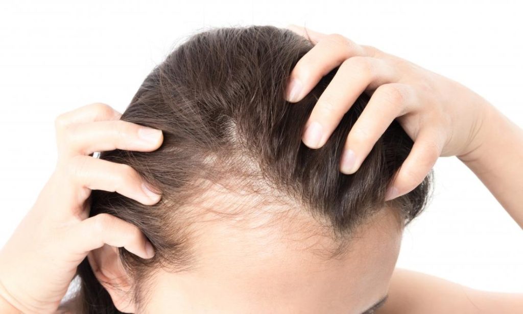 Revolutionizing Hair Loss Solutions: Exosomes Treatment at Clinique Anti Aging