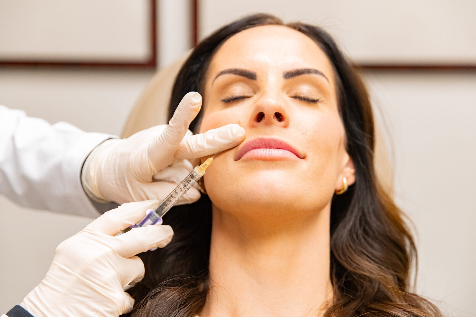 A Beginner’s Guide to Lip Filler Injections: What to Expect