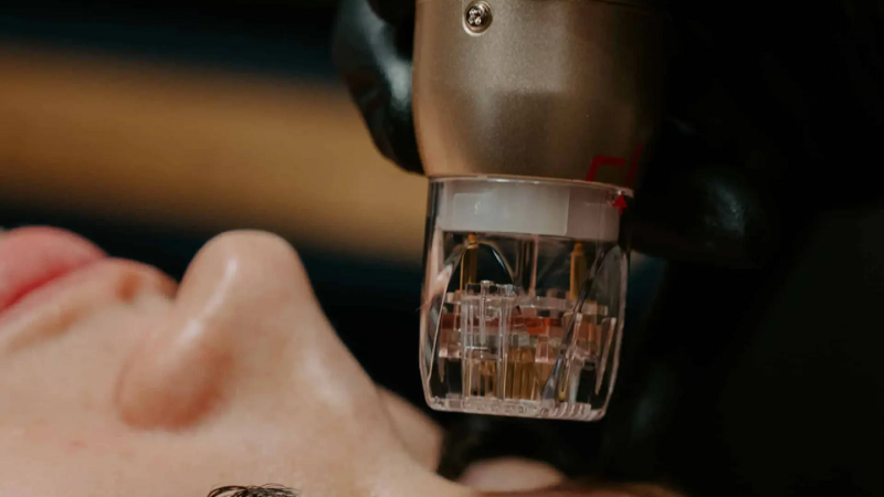 Rejuvenate Your Skin with Facials: The Ultimate Path to Radiance and Renewal