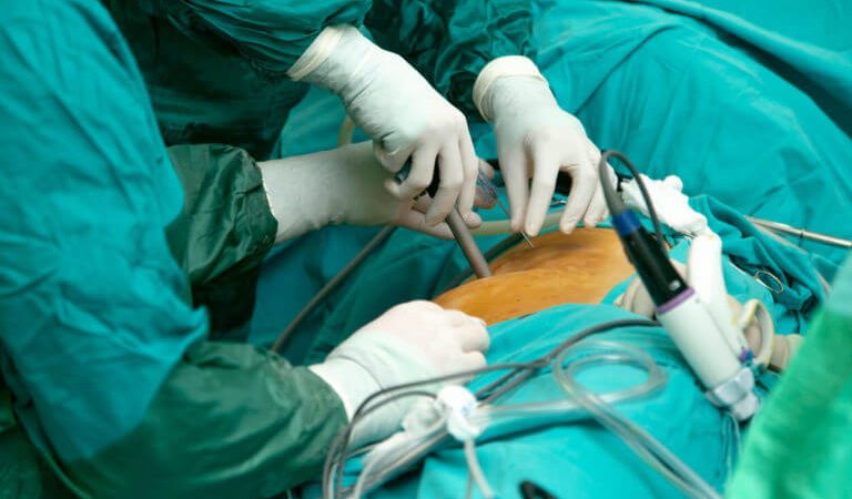 Minimally Invasive Techniques in Spinal Cord Injury Surgery: Reducing Trauma, Accelerating Recovery
