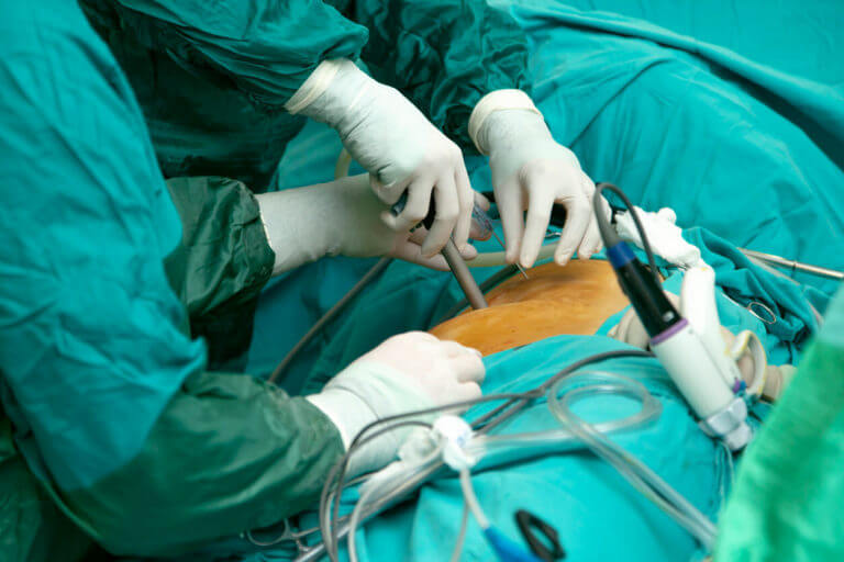 Minimally Invasive Techniques in Spinal Cord Injury Surgery: Reducing Trauma, Accelerating Recovery